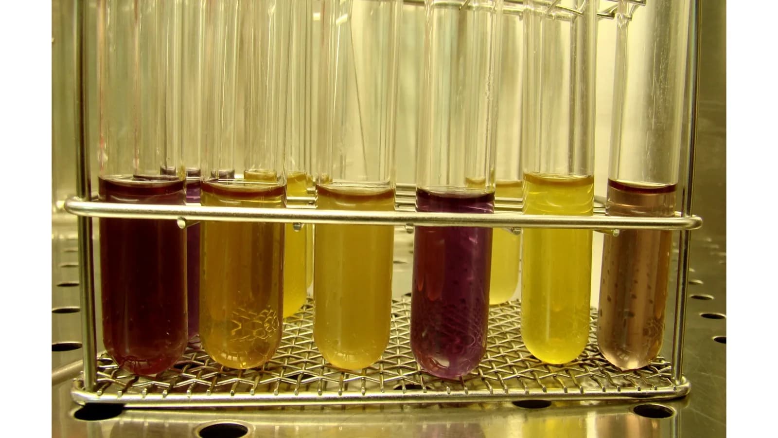 Tubos de ensaio com amostras coloridas em análise microbiológica de laboratório (foto ilustrativa)